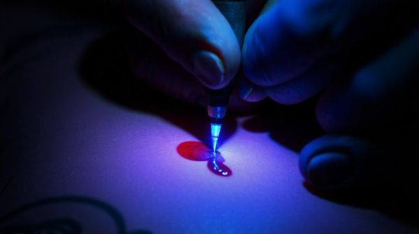Les étapes essentielles du détatouage au laser révélées